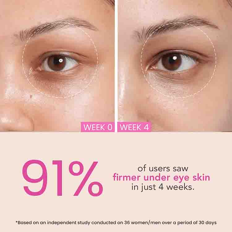O3+ BRIGHT EYE CREAM 15 GM
