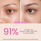 O3+ BRIGHT EYE CREAM 15 GM