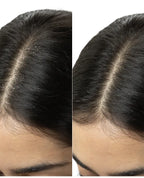 Brillare dandruff control shampoo 300ml