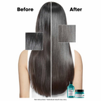 LOREAL PROFESSIONAL SCALP ADV ANTI GRAS OILINESS SHAMPOO 300ML