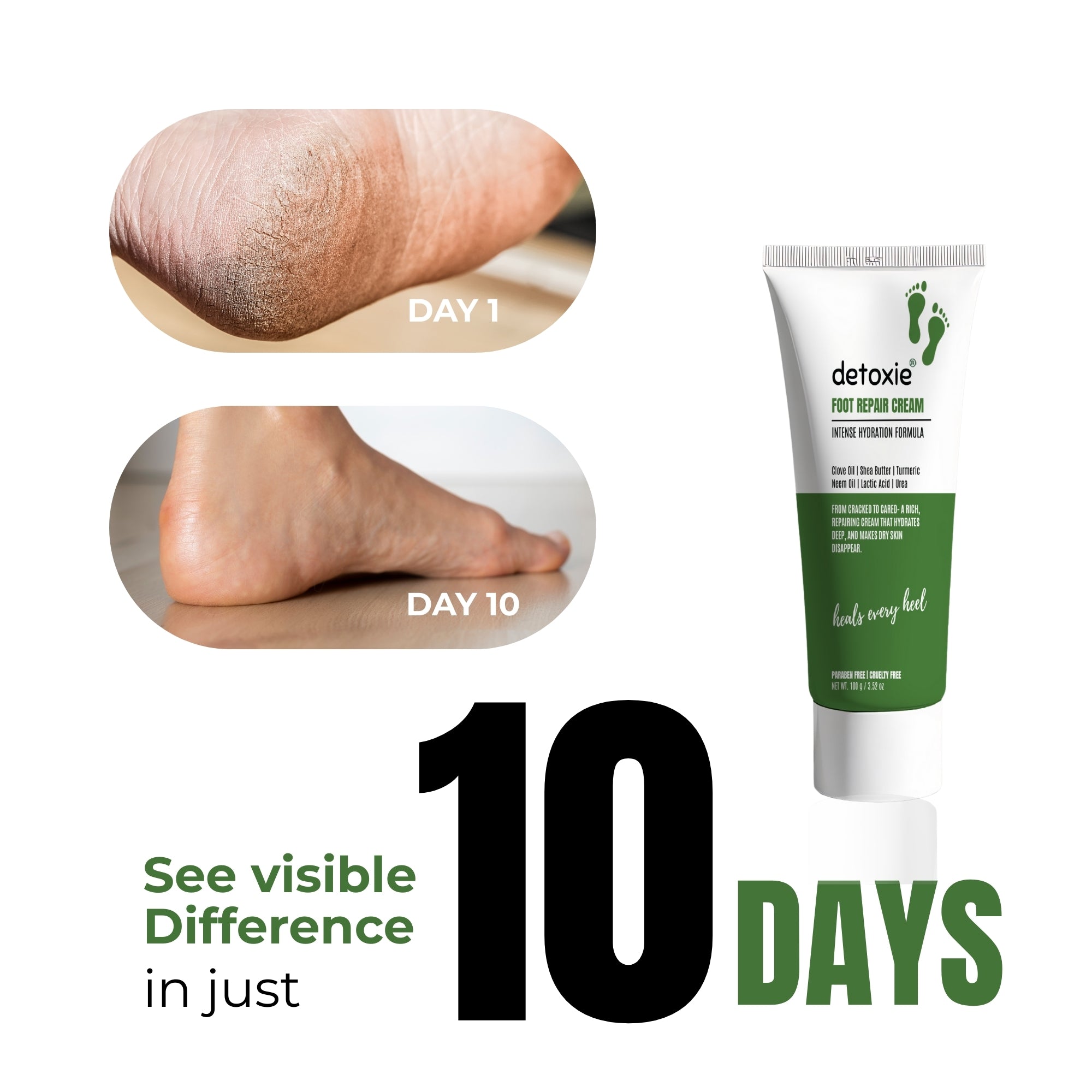 detoxie Foot Repair & Softening Cream -100g