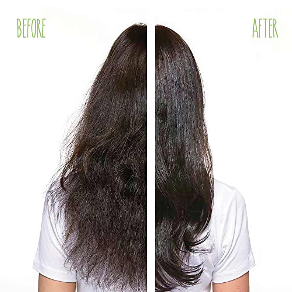 MATRIX BIO SCALP HAIR TREATMENT 10*6 MLD