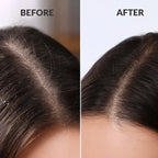 ScalpSense Hydra Soothe Shampoo-1000ML