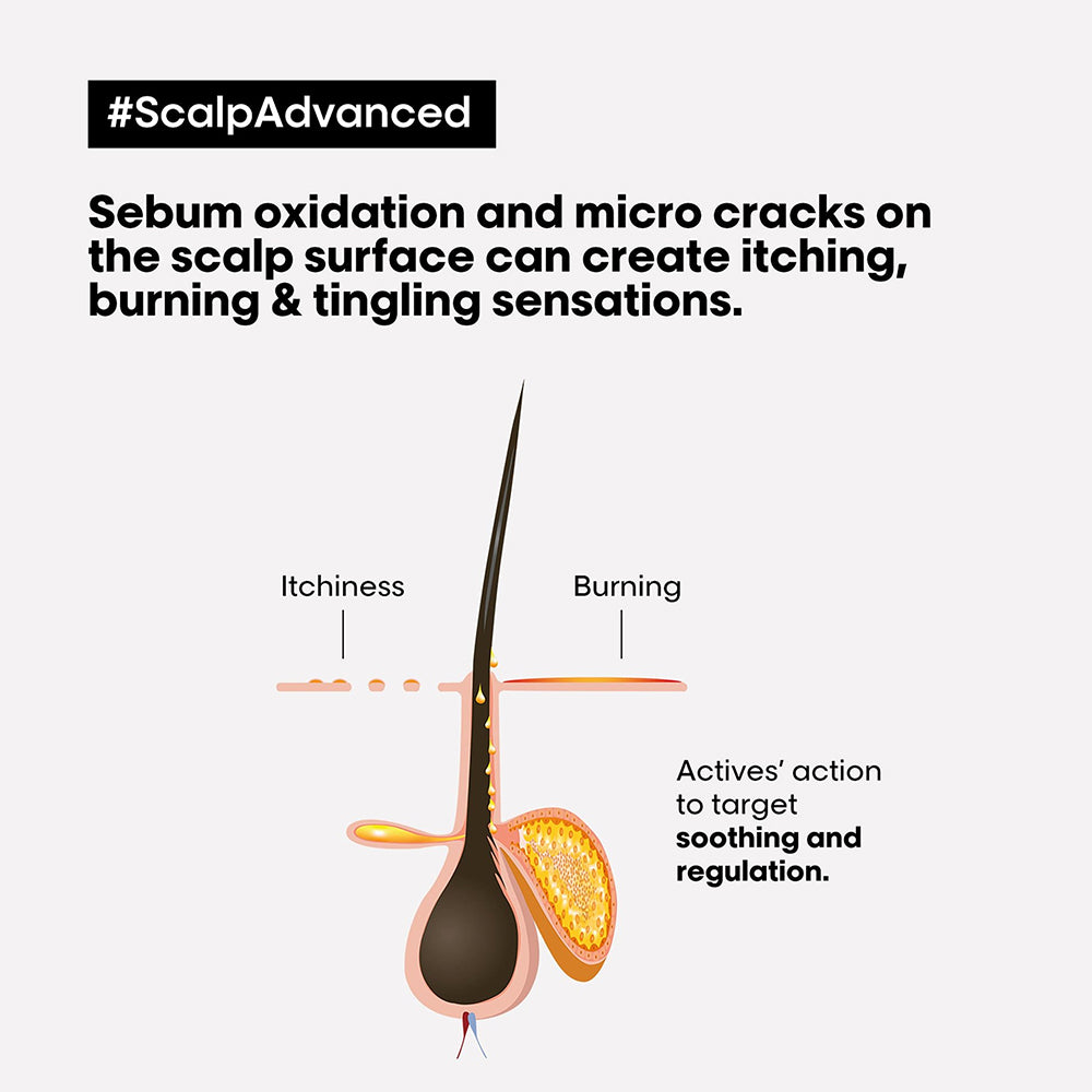 LOREAL PROFESSIONAL SCALP ADV ANTI INCONFORT TREATMENT 200ML