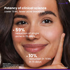 Venusia Acne Facewash 75g