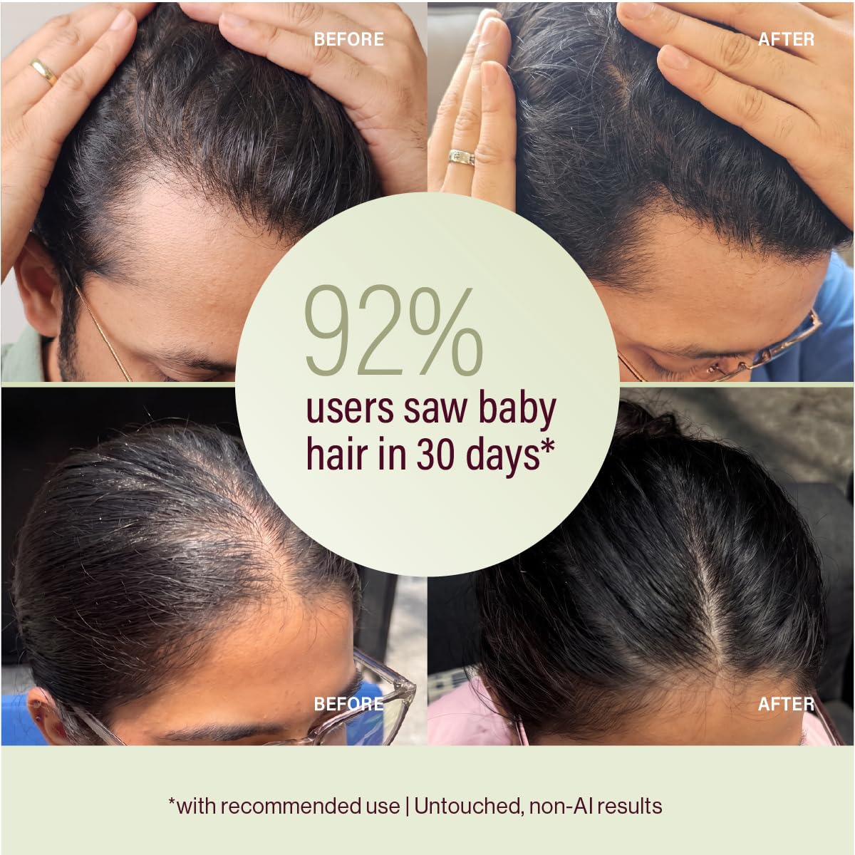 &Done Hair Growth Serum for Scalp 30ml