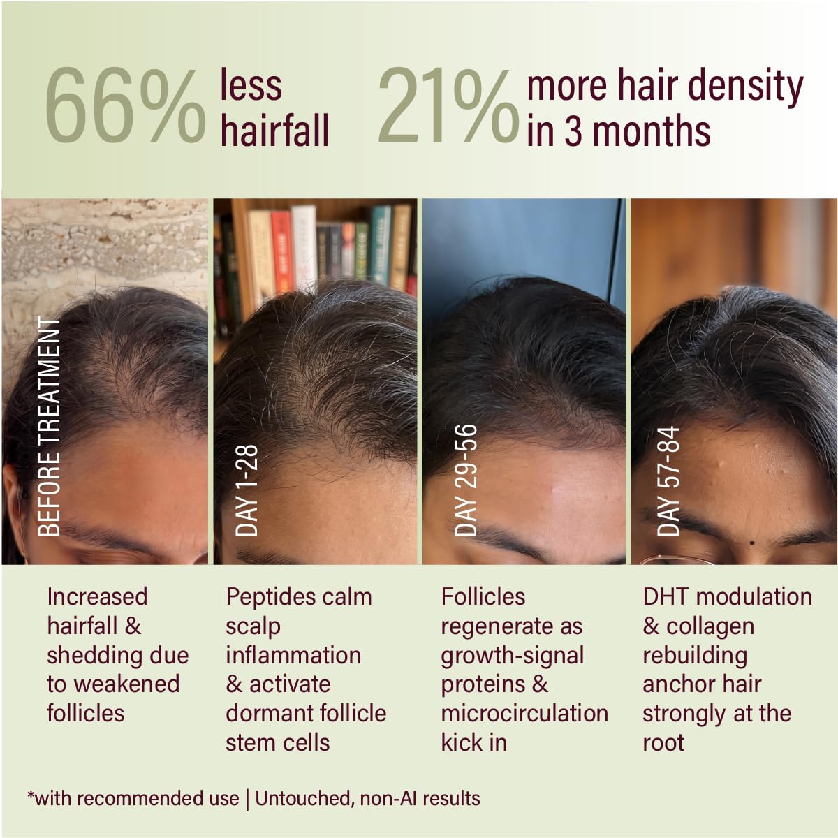 &Done Hair Growth Serum for Scalp 30ml
