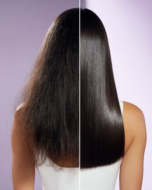 Hairfall/Hair Thinning