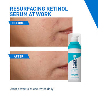 CeraVe Resurfacing Retinol Serum-30ml