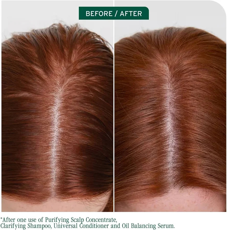 Matrix Biolage Scalp SYNC ANTI-DANDRUFF SHAMPOO 1000ML