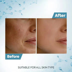 Raaga Professional De-Tan Tan Removal Cream single use